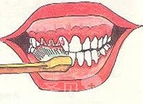 洗牙对牙齿有好处吗