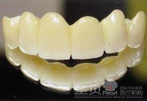牙冠修复的材质有哪些