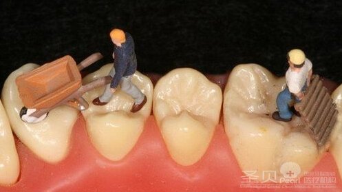 西安牙齿缺失用哪些修复方法好