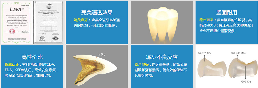 美观逼真 推荐度 使用寿命:  使用得当可使用终生 圣贝口腔烤瓷牙